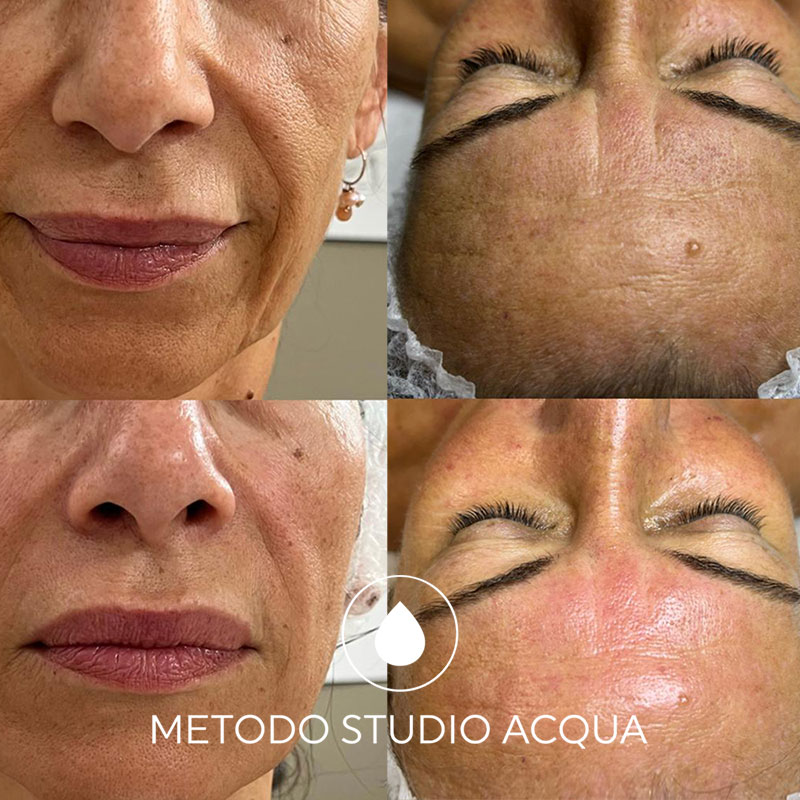 metodo-studio-acqua-forli