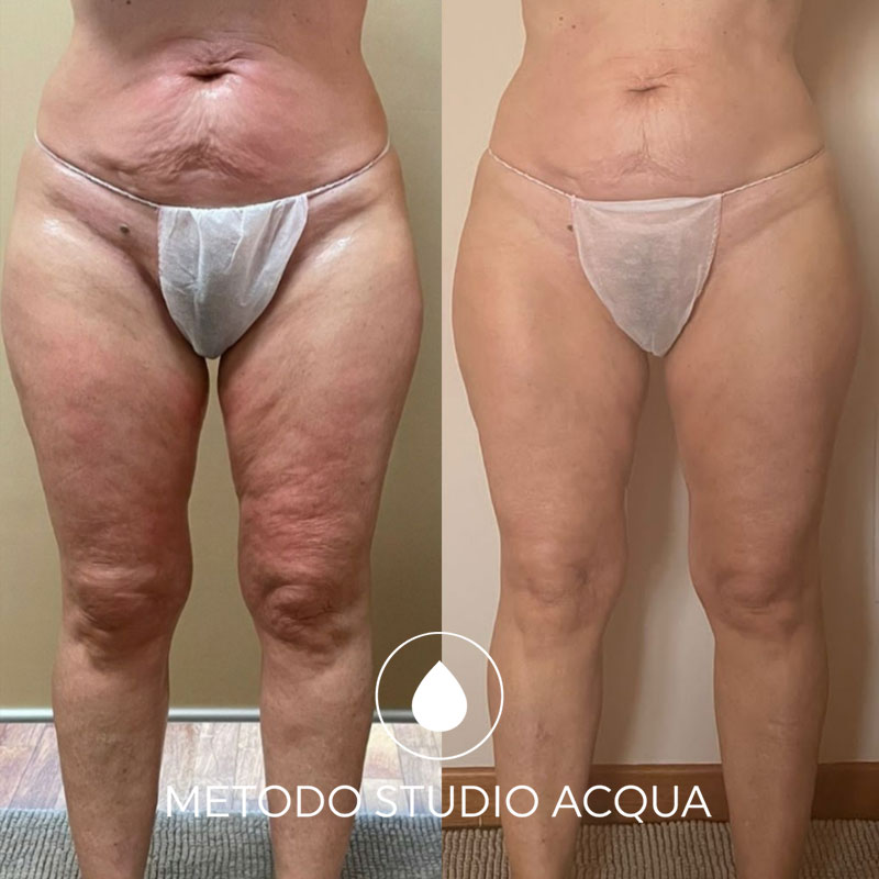 metodo-studio-acqua-risultati